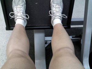 knee surgery update - week 3.5